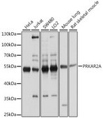 Anti-PRKAR2A antibody produced in rabbit