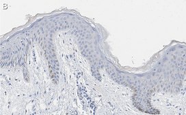 Anti-pan-cytokeratin Antibody, clone AE1 ZooMAb® Mouse Monoclonal recombinant, expressed in HEK 293 cells