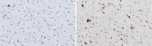 Anti-APP Antibody, clone 5D16, ZooMAb® Rabbit Monoclonal recombinant, expressed in HEK 293 cells