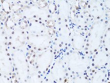 Anti- Histone H2B antibody produced in rabbit