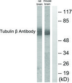 抗-微管蛋白 β 兔抗 affinity isolated antibody