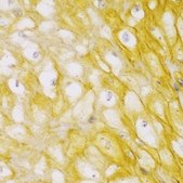 Anti-ACTN1 antibody produced in rabbit