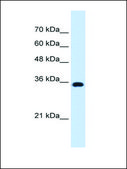 Anti-ATP1B1 antibody produced in rabbit affinity isolated antibody