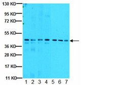 抗酪蛋白激酶2α 抗体，1AD9 clone 1AD9, from mouse