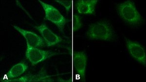 Anti-GRP78/BiP (ET-21) antibody produced in rabbit IgG fraction of antiserum, buffered aqueous solution
