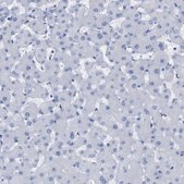 抗-P2RY12 兔抗 Prestige Antibodies® Powered by Atlas Antibodies, affinity isolated antibody, buffered aqueous glycerol solution