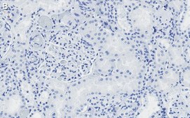 Anti-CDK6 Antibody, clone 2J3 ZooMAb® Rabbit Monoclonal recombinant, expressed in HEK 293 cells