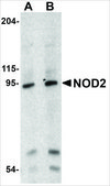 Anti-NOD2 (ab2) antibody produced in rabbit affinity isolated antibody, buffered aqueous solution