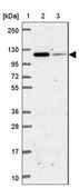 Anti-IDE antibody produced in rabbit Prestige Antibodies® Powered by Atlas Antibodies, affinity isolated antibody, buffered aqueous glycerol solution