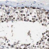 Anti-PITRM1 antibody produced in rabbit Ab2, Prestige Antibodies® Powered by Atlas Antibodies, affinity isolated antibody, buffered aqueous glycerol solution