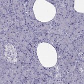 Anti-TRPM7 antibody produced in rabbit Prestige Antibodies® Powered by Atlas Antibodies, affinity isolated antibody