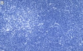 Anti-PKCβ Antibody, clone 2E13 ZooMAb® Rabbit Monoclonal recombinant, expressed in HEK 293 cells