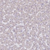 Anti-PGAM2 antibody produced in rabbit Prestige Antibodies® Powered by Atlas Antibodies, affinity isolated antibody, buffered aqueous glycerol solution