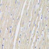 Anti- TTC11/FIS1 antibody produced in rabbit