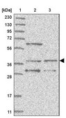 Anti-WDR92 antibody produced in rabbit Prestige Antibodies® Powered by Atlas Antibodies, affinity isolated antibody, buffered aqueous glycerol solution