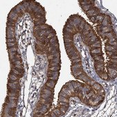 Anti-GCLC antibody produced in rabbit Prestige Antibodies® Powered by Atlas Antibodies, affinity isolated antibody, buffered aqueous glycerol solution