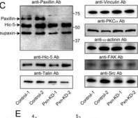 Anti-Vinculin Antibody, clone V284 clone V284, Upstate®, from mouse