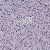 Anti-TLN2 Prestige Antibodies® Powered by Atlas Antibodies, affinity isolated antibody