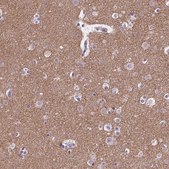Anti-SYN1 antibody produced in rabbit Prestige Antibodies® Powered by Atlas Antibodies, affinity isolated antibody, buffered aqueous glycerol solution