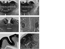 抗-GABA B受体R1抗体 serum, from guinea pig