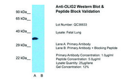 Anti-OLIG2 (AB1) antibody produced in rabbit affinity isolated antibody