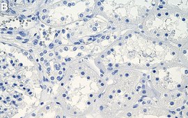 Anti-EBP/NHERF-1 Antibody, clone 1G10 ZooMAb® Rabbit Monoclonal recombinant, expressed in HEK 293 cells