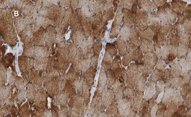 Anti-Desmin Antibody, clone 1H16, ZooMAb® Rabbit Monoclonal recombinant, expressed in HEK 293 cells