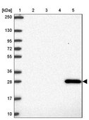 Anti-GSTA1 antibody produced in rabbit Prestige Antibodies® Powered by Atlas Antibodies, affinity isolated antibody, buffered aqueous glycerol solution