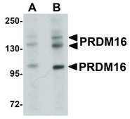 Anti-PRDM16 antibody produced in rabbit affinity isolated antibody