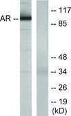 Anti-Androgen Receptor antibody produced in rabbit affinity isolated antibody