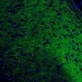 Anti-OPRM1 antibody produced in rabbit Prestige Antibodies® Powered by Atlas Antibodies, affinity isolated antibody, buffered aqueous glycerol solution