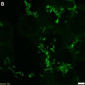 Anti-ROR2 clone XBR2-401 ZooMAb® Rabbit Monoclonal recombinant, expressed in HEK 293 cells