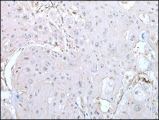 Anti-DUSP3 affinity isolated antibody