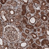 Monoclonal Anti-GAPDH antibody produced in mouse Prestige Antibodies® Powered by Atlas Antibodies, clone CL3265, purified immunoglobulin