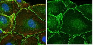 Anti-β-Catenin Antibody Upstate®, from rabbit