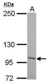 抗-ENPP2 兔抗 affinity isolated antibody, buffered aqueous solution