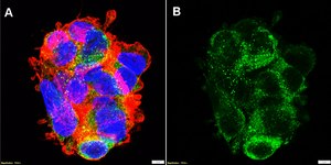 Anti-ApoB Antibody, clone MB47 ZooMAb® Mouse Monoclonal recombinant, expressed in HEK 293 cells