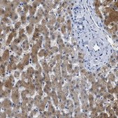 Anti-ADH4 antibody produced in rabbit Prestige Antibodies® Powered by Atlas Antibodies, affinity isolated antibody, buffered aqueous glycerol solution