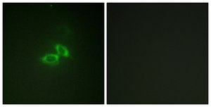 Anti-NMDAR1 antibody produced in rabbit affinity isolated antibody