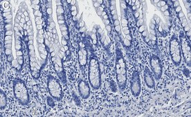 Anti-Vitamin D3 Receptor Antibody, clone 1M19 ZooMAb® Rabbit Monoclonal recombinant, expressed in HEK 293 cells