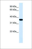 Anti-HMOX1 affinity isolated antibody