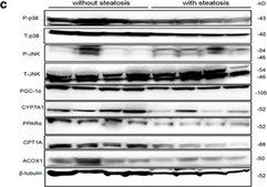 Anti-Cyp7a1 Antibody, clone 15B9.1 clone 15B9.1, from mouse