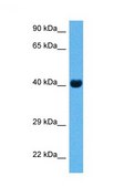 Anti-CKM (ab1) antibody produced in rabbit affinity isolated antibody