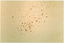 Anti-Synuclein α Antibody serum, Chemicon®