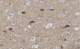 Anti-Neurogranin Antibody, clone 1D4 , ZooMAb® Rabbit Monoclonal recombinant, expressed in HEK 293 cells