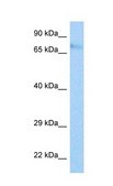 Anti-IFI204 antibody produced in rabbit affinity isolated antibody