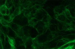 Anti-Cytokeratin pan antibody, Mouse monoclonal clone C-11, purified from hybridoma cell culture