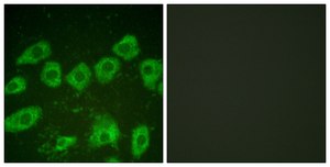 Anti-Tyrosine Hydroxylase, N-Terminal antibody produced in rabbit affinity isolated antibody