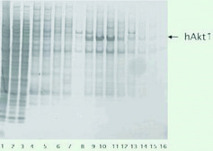cOmplete™, EDTA-free Protease Inhibitor Cocktail Tablets provided in glass vials