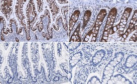 抗E钙粘蛋白抗体 serum, Upstate®